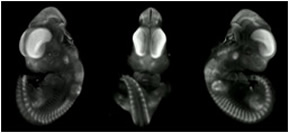 3-D reconstruction of a theiler stage 19 mouse embryo in situ hybridized with a frizzled 8 probe